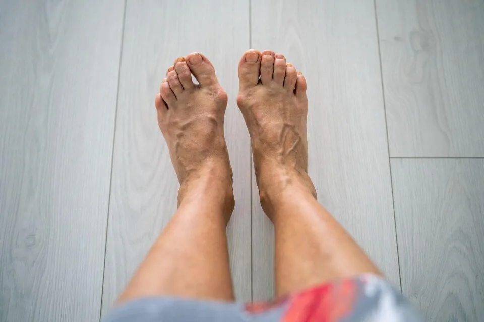 Toenail Care for Seniors Canberra