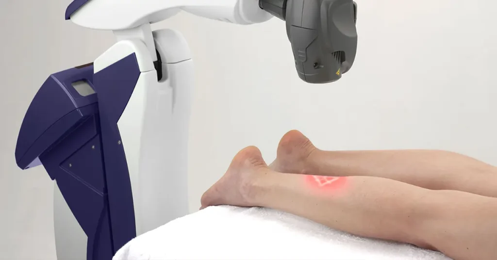 MLS Laser Therapy Canberra